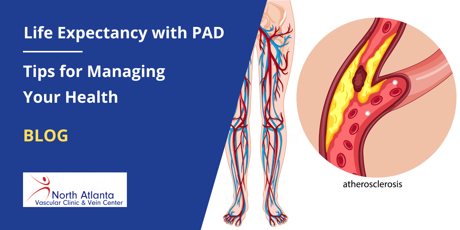 Life Expectancy with PAD: Tips for Managing Your Health