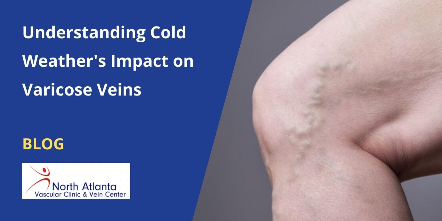 Understanding Cold Weather's Impact on Varicose Veins