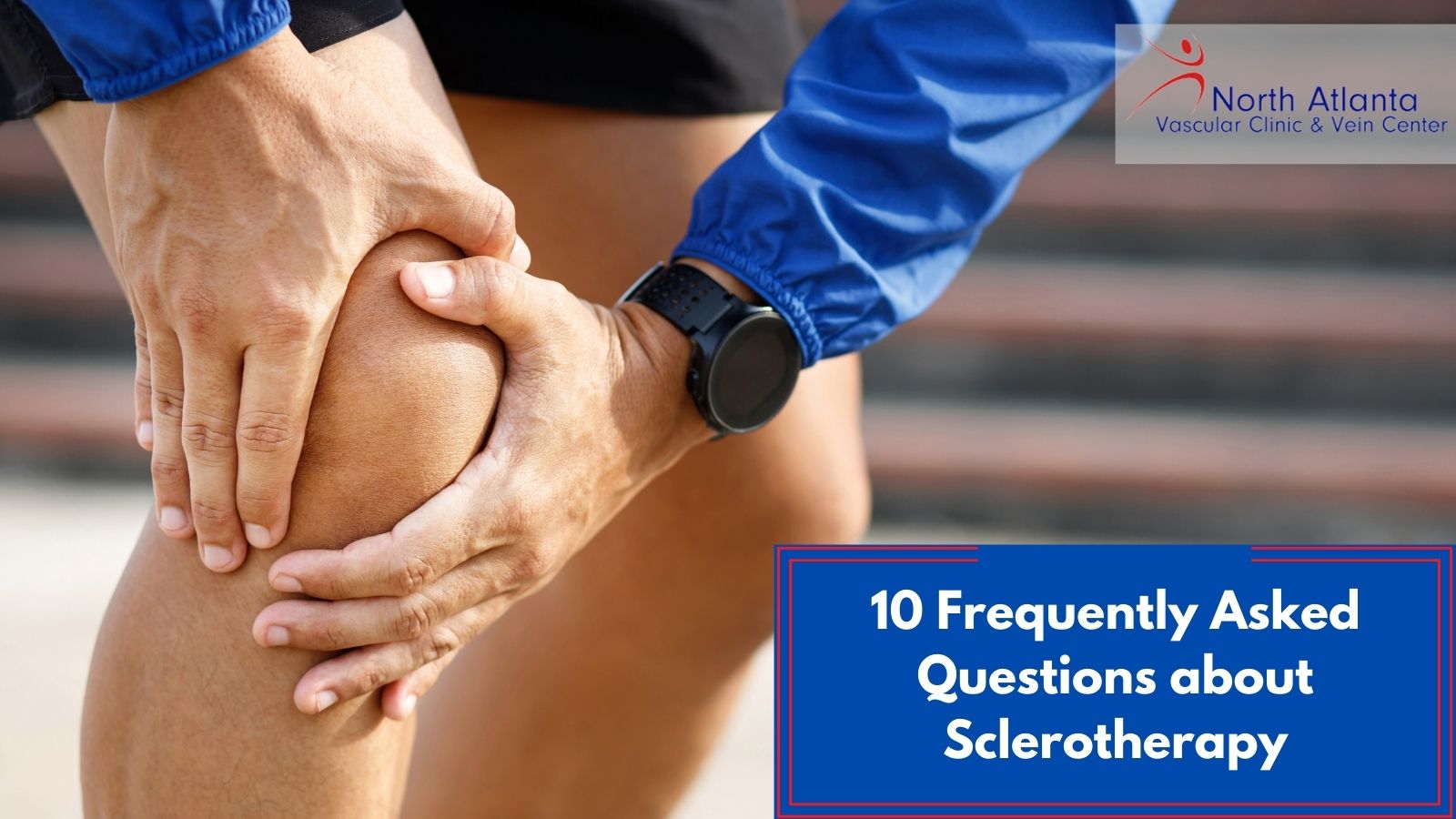 10 Frequently Asked Questions about Sclerotherapy