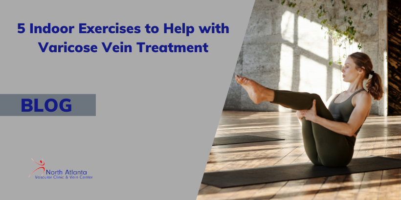 5 Indoor Exercises to Help with Varicose Vein Treatment
