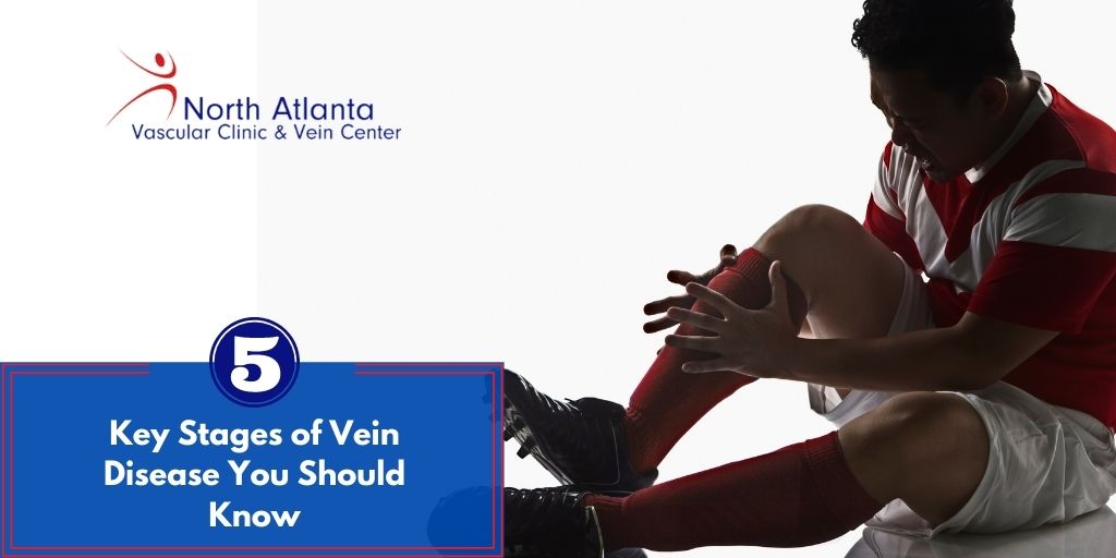 Five Key Stages of Vein Disease You Should Know