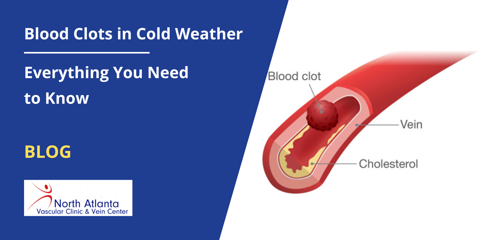 Causes of Blood Clots in the Hand - Lesson