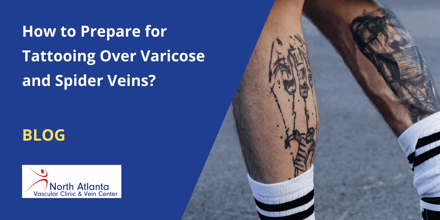 How to Prepare for Tattooing Over Varicose and Spider Veins?