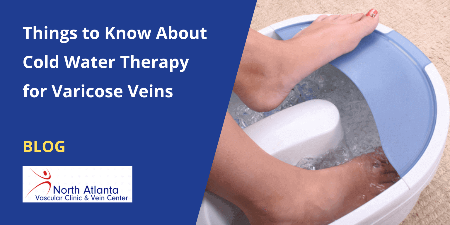 Things to Know About Cold Water Therapy for Varicose Veins
