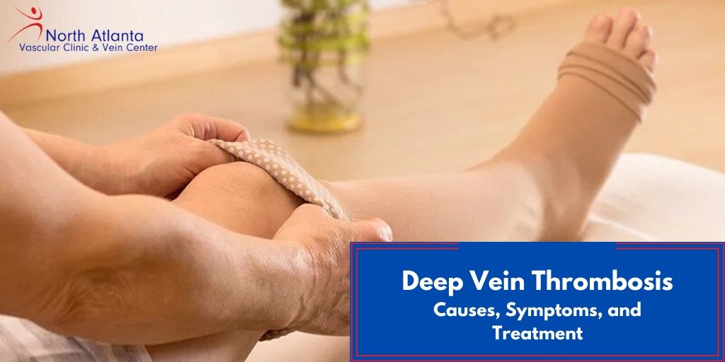 Deep Vein Thrombosis: Causes, Symptoms, and Treatment Options