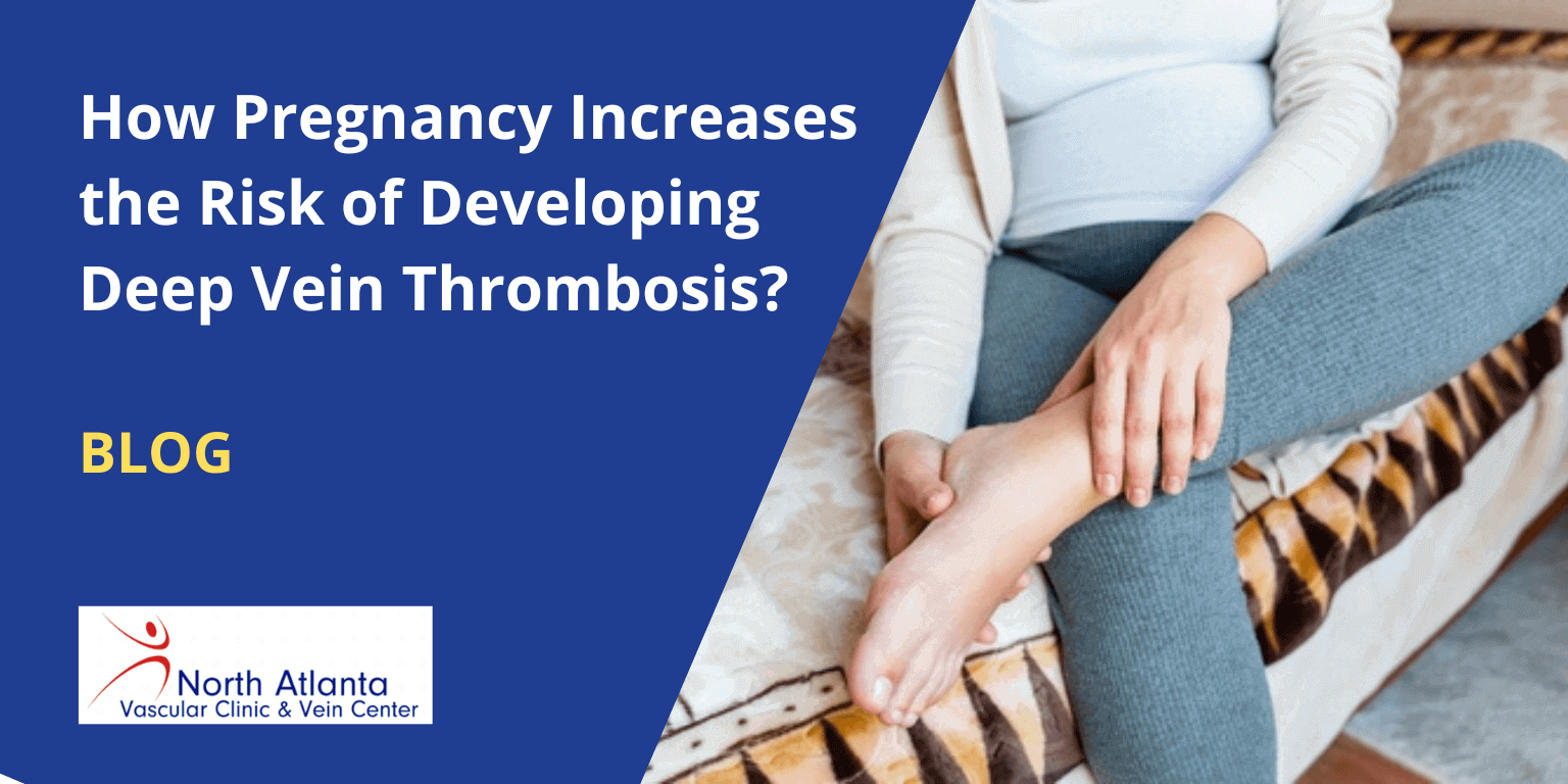 How Pregnancy Increases the Risk of Developing Deep Vein Thrombosis