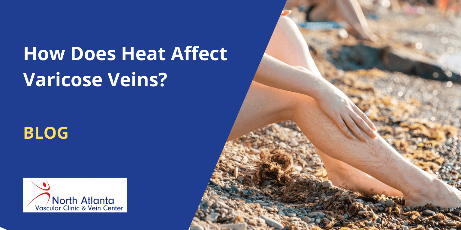 How Does Heat Affect Varicose Veins?