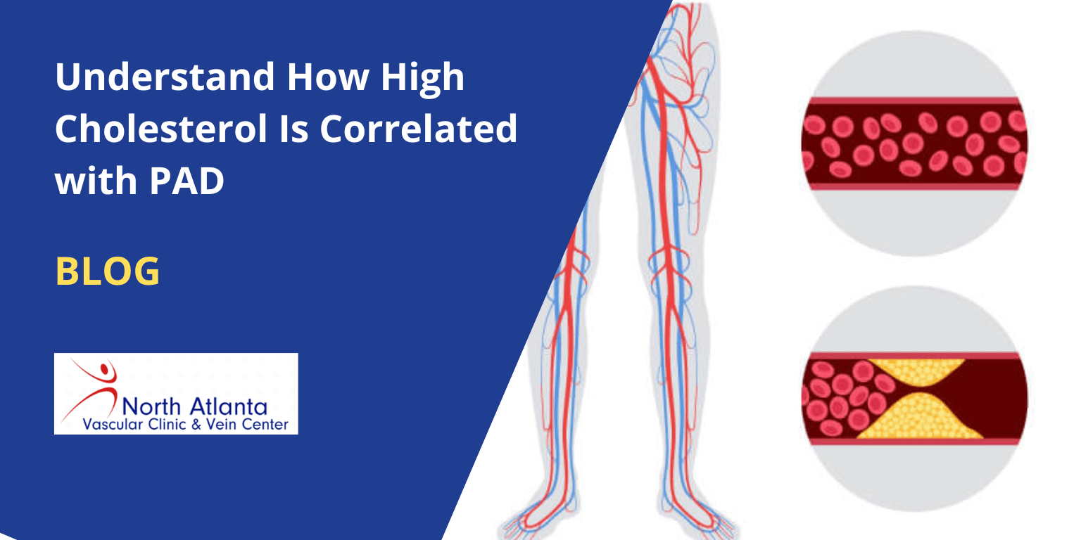 Understand How High Cholesterol Is Correlated with PAD