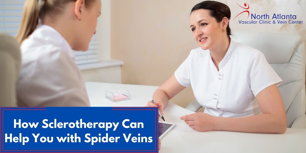 How Sclerotherapy Can Help You with Spider Veins