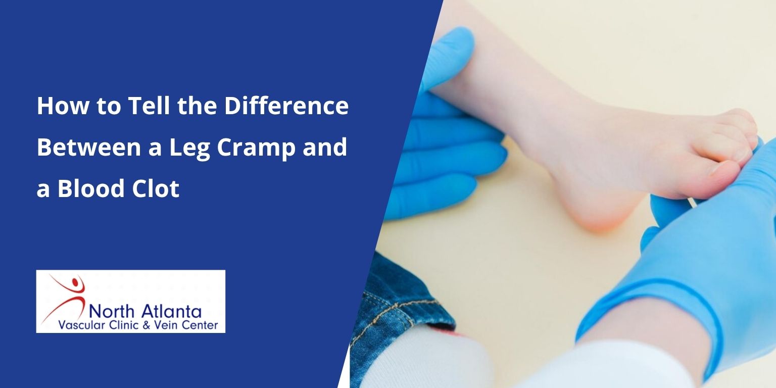 How to Tell the Difference Between a Leg Cramp and a Blood Clot