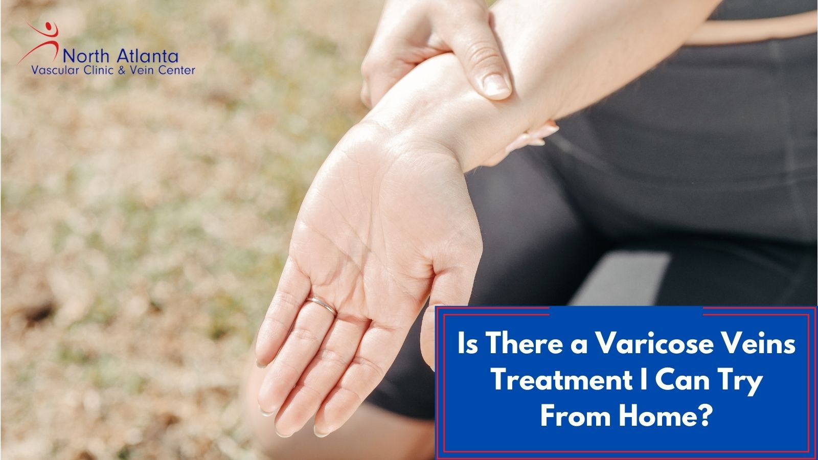 Is There a Varicose Veins Treatment I Can Try From Home?