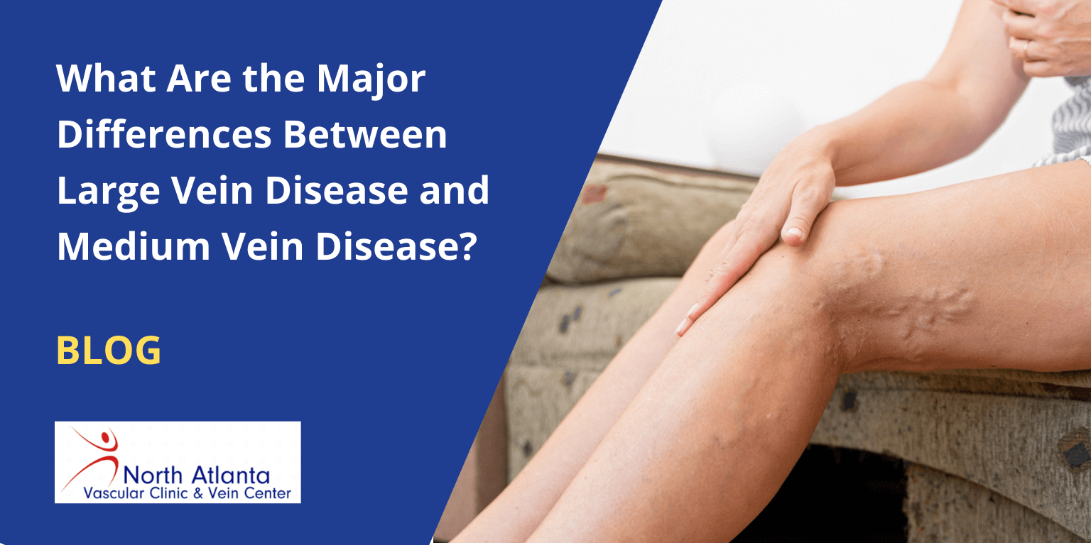 What Are the Major Differences Between Large Vein Disease and Medium Vein Disease?