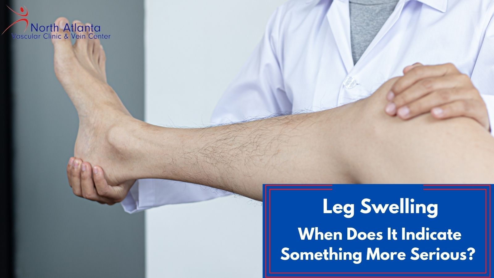 Leg Swelling: When Does It Indicate Something More Serious?