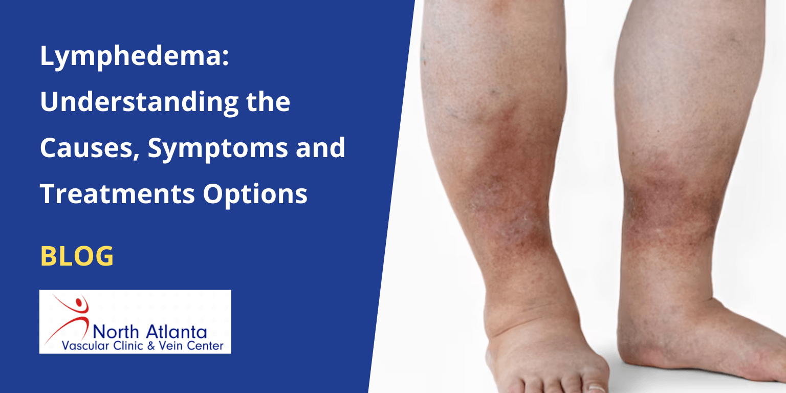Lymphedema: Understanding the Causes, Symptoms and Treatments Options