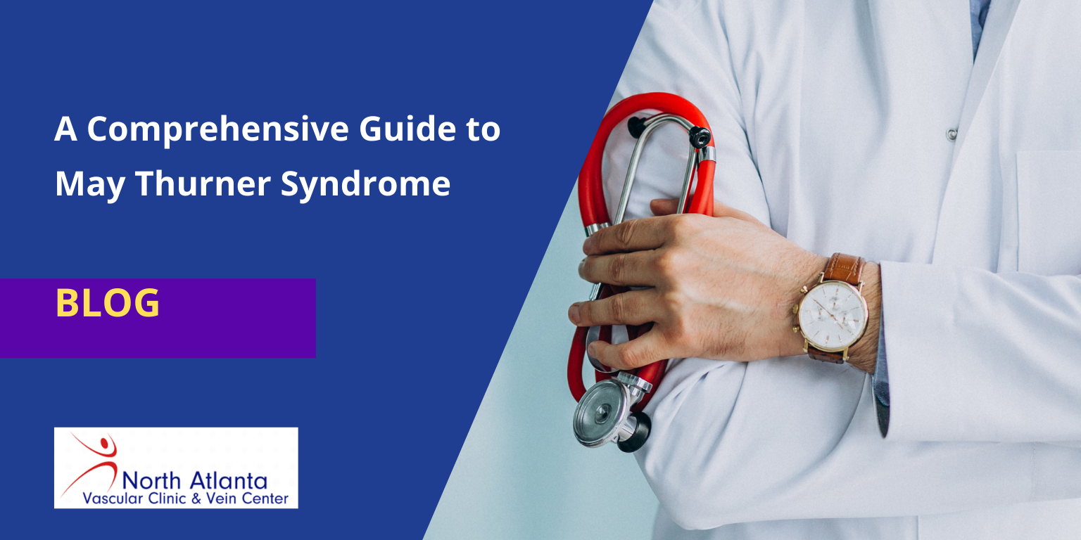 A Comprehensive Guide to May Thurner Syndrome