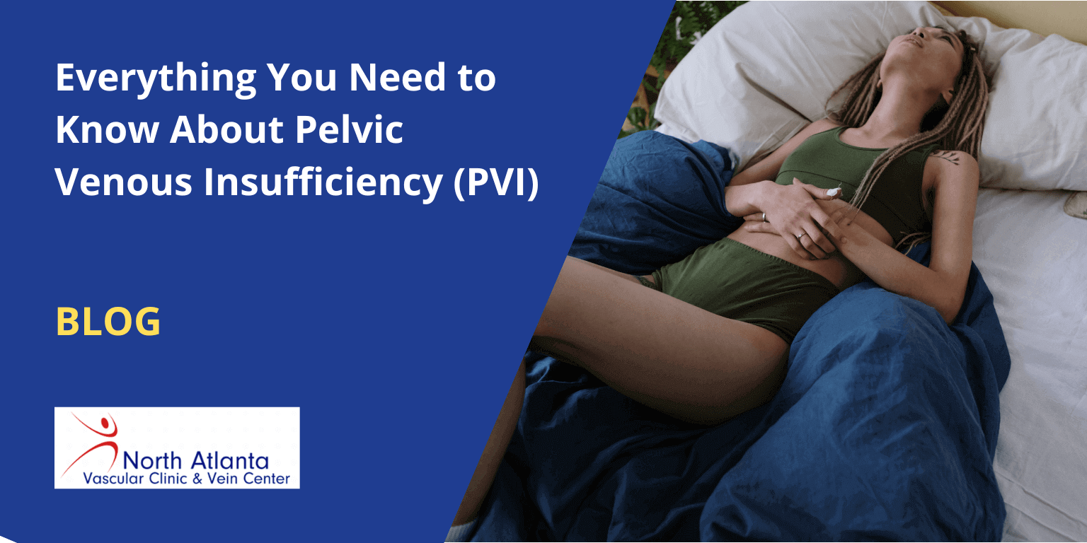 Everything You Need to Know About Pelvic Venous Insufficiency (PVI)