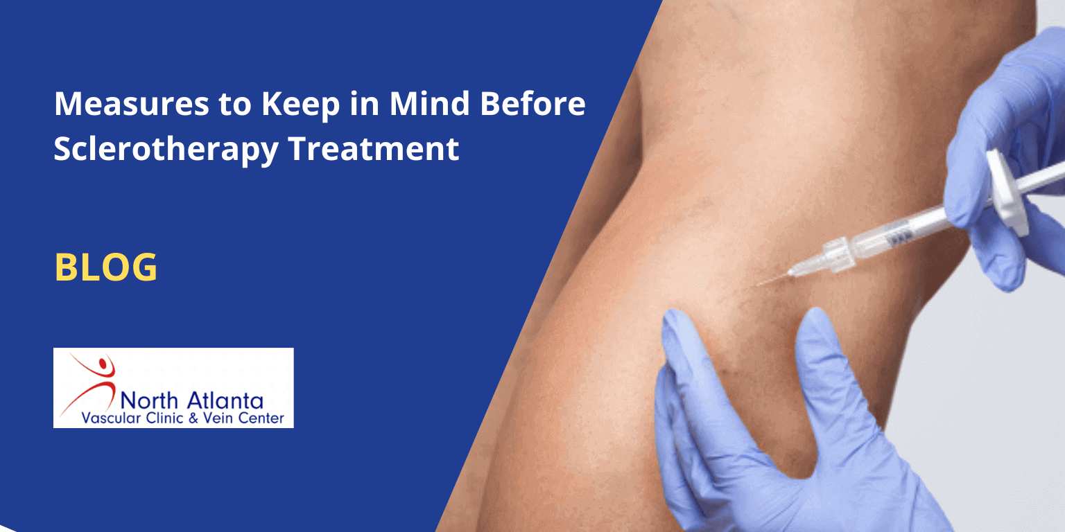 Measures to Keep in Mind Before Sclerotherapy Treatment