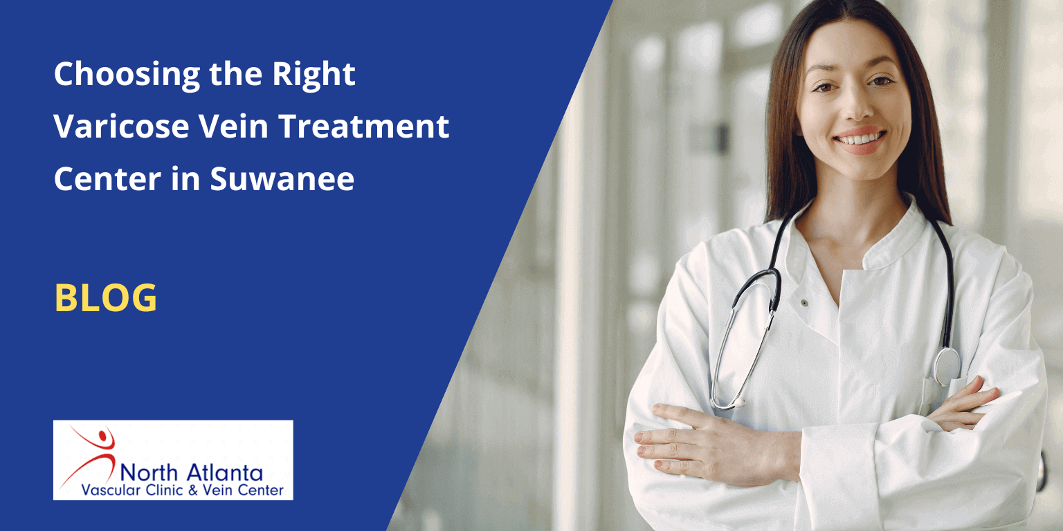 Choosing the Right Varicose Vein Treatment Center in Suwanee