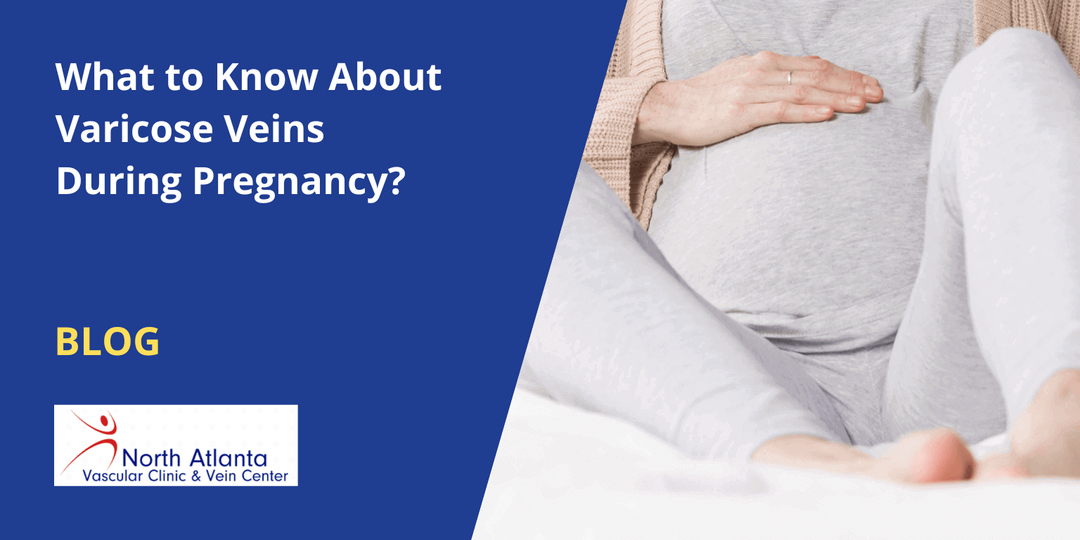 What to Know About Varicose Veins During Pregnancy?