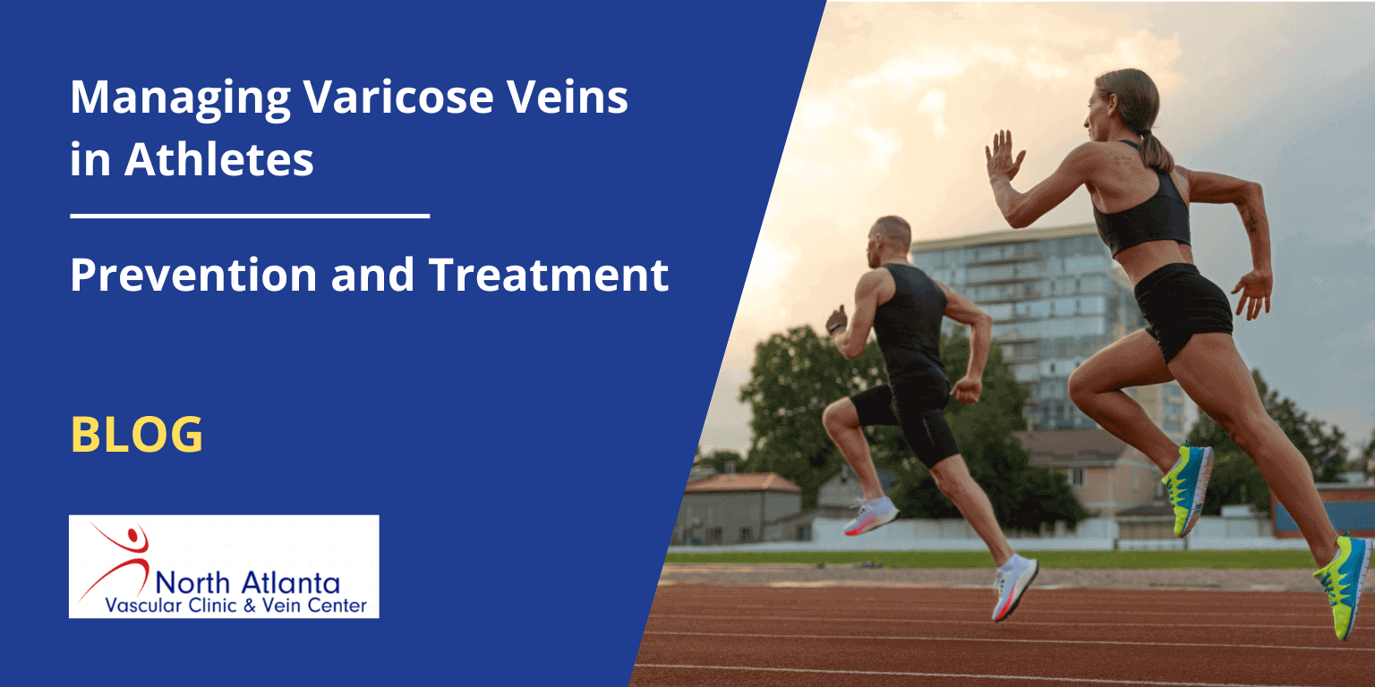 Managing Varicose Veins in Athletes: Prevention and Treatment