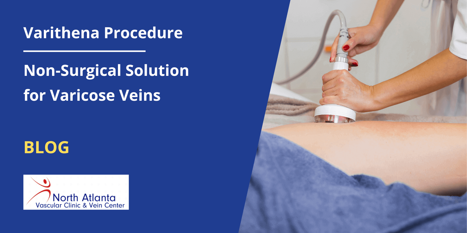 Varithena Procedure: Non-Surgical Solution for Varicose Veins
