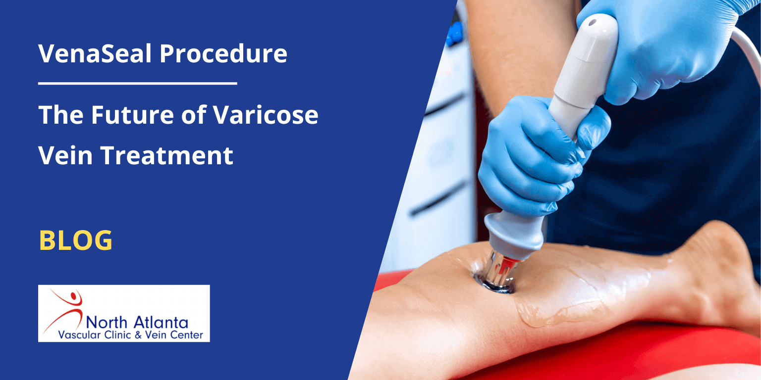 VenaSeal Procedure: The Future of Varicose Vein Treatment