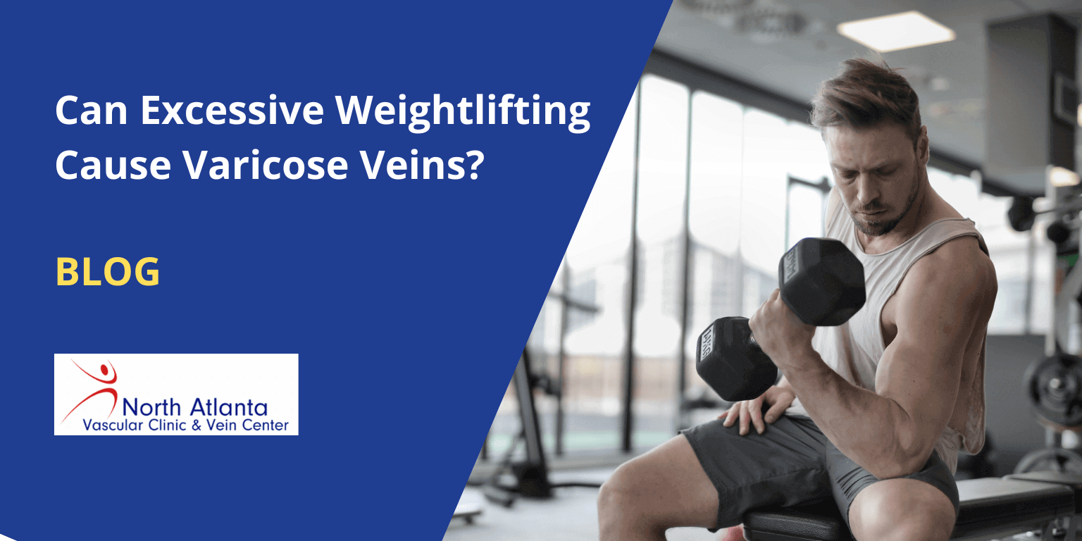 Can Excessive Weightlifting Cause Varicose Veins?